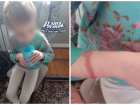 В Новошахтинске родителей, истязавших свою дочь, арестовали