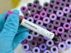 Стала известна цена платных тестов на коронавирус в Ростове