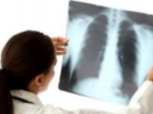 У врача ростовского роддома выявили туберкулез