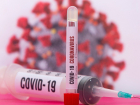 Четыре пациента с коронавирусом умерли в Ростовской области