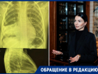 В Ростове у маленькой девочки в частной медицинской клинике не заметили пневмонию