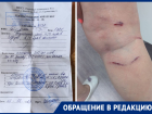 Ростовчане массово жалуются на нападения бездомных собак в ЖК «Платовский»