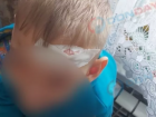«Везли с дыркой во лбу»: в донском городе ребёнку с пробитой головой не смогли помочь из-за отсутствия хирурга