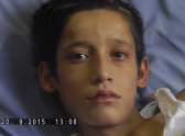 12-летний подросток остался без ног после бомбежки ИГИЛ