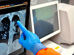 В минздраве Ростовской области назвали опасные сопутствующие заболевания при коронавирусе