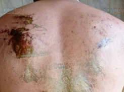 Дикую боль и адские страдания испытал облитый кислотой мужчина на остановке Ростовской области