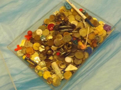 Удивительная коллекция извлеченных из детей странных предметов шокировала жителей Ростова