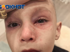 Семилетний мальчик травмировал глаз на детской площадке Ростова из-за неотремонтированного ограждения 