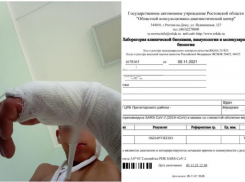 В донском оздоровительном лагере, где серьезно покалечился подросток, провели проверку 