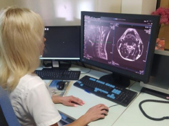 В Ростове тренер по прыжкам на батуте потеряла сознание во время тренировки 