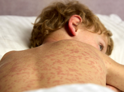 Вакцину от кори для детей нашли в Ростовской области после ее пропажи в июне