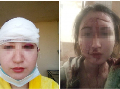 В Ростове отчим жестоко избил девушку, которая вступилась за маму