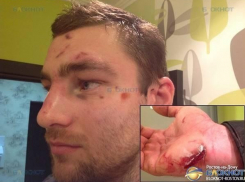 В Ростове установлены личности нападавших на члена олимпийской сборной по гребле Игоря Салова 