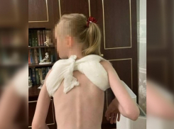 10-летний самокатчик сбил 7-летнюю девочку и сломал ей ключицу в Батайске