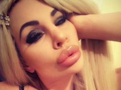 Знаменитая жертва пластической операции из Ростова изуродовала попу для бразильских трусиков