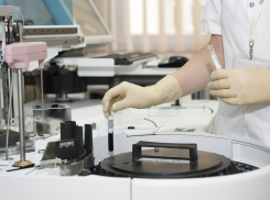 Еще 158 случаев коронавируса выявлено в Ростовской области