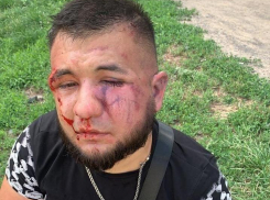 В Ростове избили блогера Гаспара Авакяна