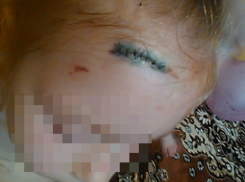 В Ростовской области 5-летняя девочка выпала из маршрутки и ударилась головой об рельсы
