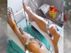 В Ростовской области школьница за рулем легковушки сбила 9-летнего велосипедиста