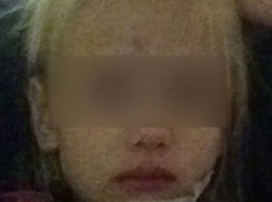 Пятилетняя девочка из Макеевки, попавшая в аварию под Таганрогом, потеряла семью