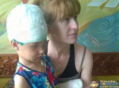В Ростовской области собака, напав на 5-летнюю девочку, сорвала ей скальп и откусила два пальца. Видео