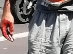 В Ростове на блошином рынке покупателю разбили голову молотком