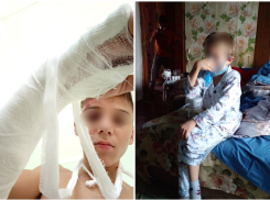 Поездка в оздоровительный лагерь обернулась для донских школьников переломами рук и коронавирусом