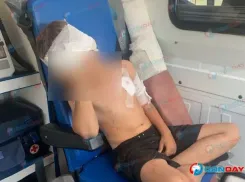 Волк покусал восьмилетнего мальчика в Ростовской области 