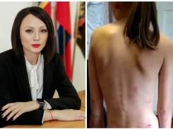Власти Шахт признали факт избиения ребенка в «образцовой» многодетной семье