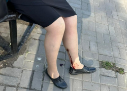 В Азове бродячая собака напала и искусала на женщину