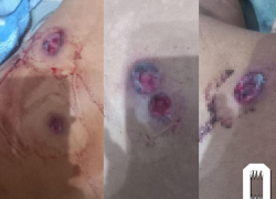 За массовое нападение на участника СВО в Батайске мужчина получил 10 лет строгого режима 