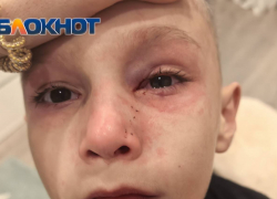 Семилетний мальчик травмировал глаз на детской площадке Ростова из-за неотремонтированного ограждения 