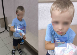 Прогулка в батайском парке для ребенка закончилась переломом и ушибами из-за самокатчика