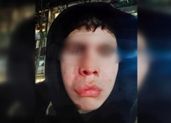 Неизвестный избил подростка ради денег в Ростове