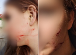 В Ростовской области женщина прилюдно избила девочку-подростка