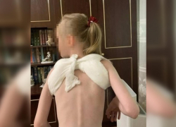 10-летний самокатчик сбил 7-летнюю девочку и сломал ей ключицу в Батайске