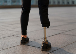 В Ростове планируется создать Центр протезирования и реабилитации