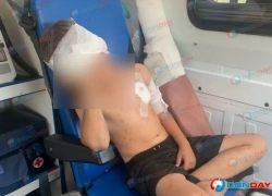 Волк покусал восьмилетнего мальчика в Ростовской области 