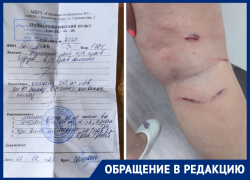 Ростовчане массово жалуются на нападения бездомных собак в ЖК «Платовский»