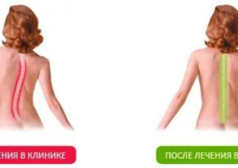 Все проблемы от позвоночника. Специалисты клиники доктора Бобыря проведут приём в Ростове