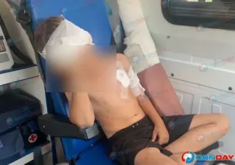 В полиции прокомментировали нападение волка на мальчика на Дону