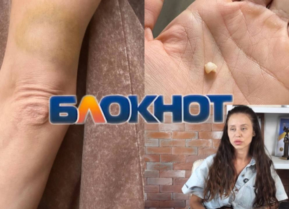 «Приехала домой, а попала в ад»: бывший муж душил и избил ростовчанку прямо в фитнес-клубе