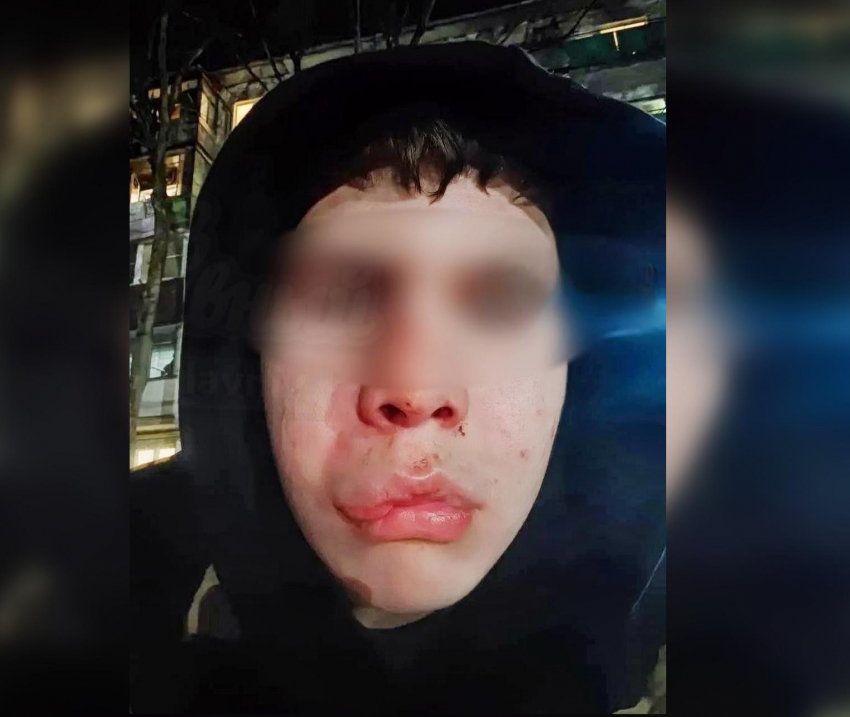 «Он с другом подрался»: информацию о нападении на подростка опровергли в ростовском следкоме