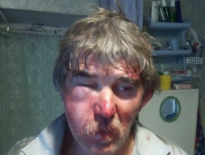 Озверевший армянин избил до полусмерти ростовчанина за «поруганную честь» своей дочери