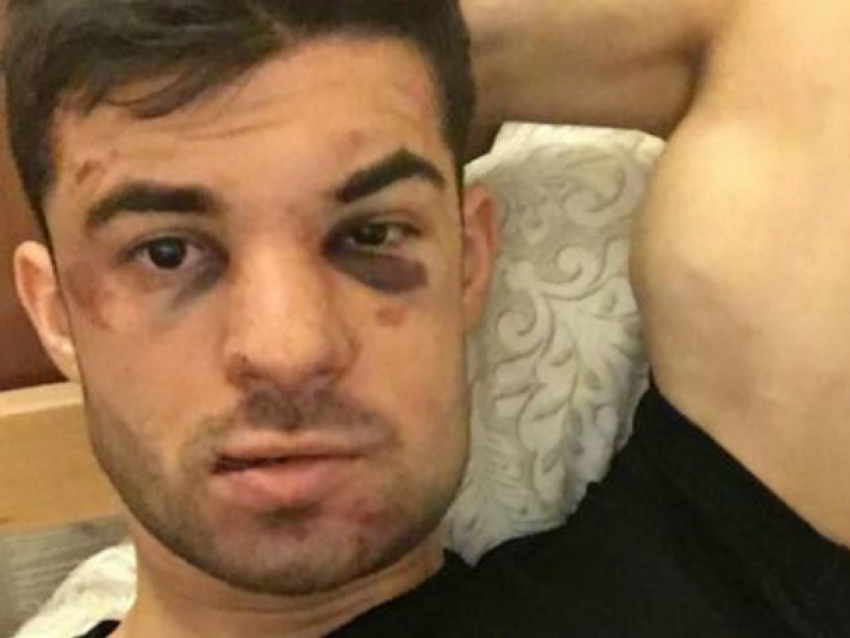 Экс-игрока ФК «Ростов» Терентьева серьезно избили из-за дорожной ссоры