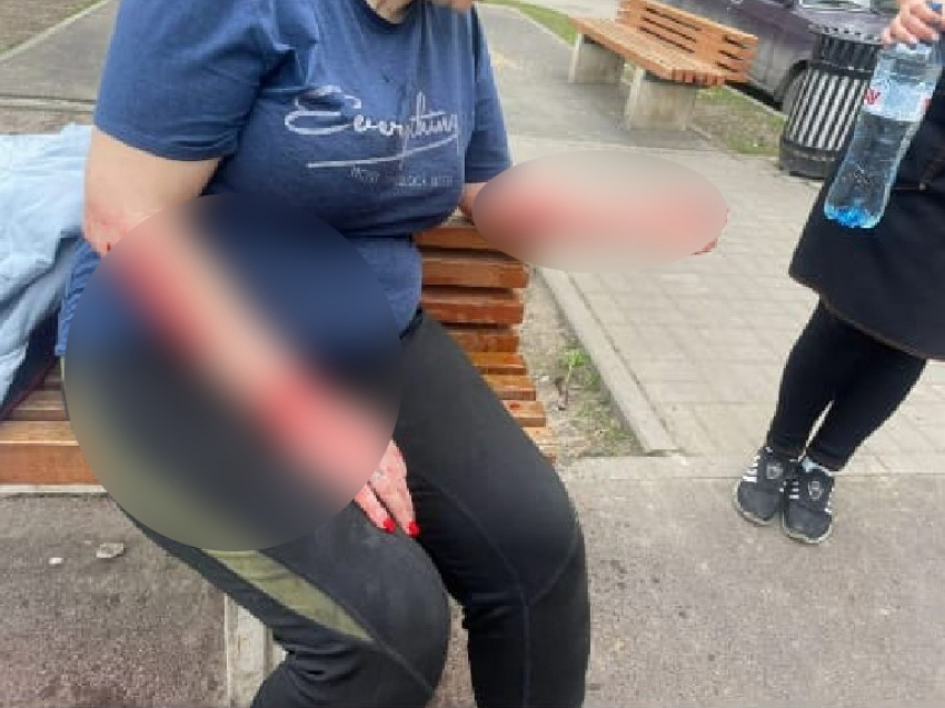 В Новочеркасске поймали собаку, которая разодрала женщине руки на детской площадке