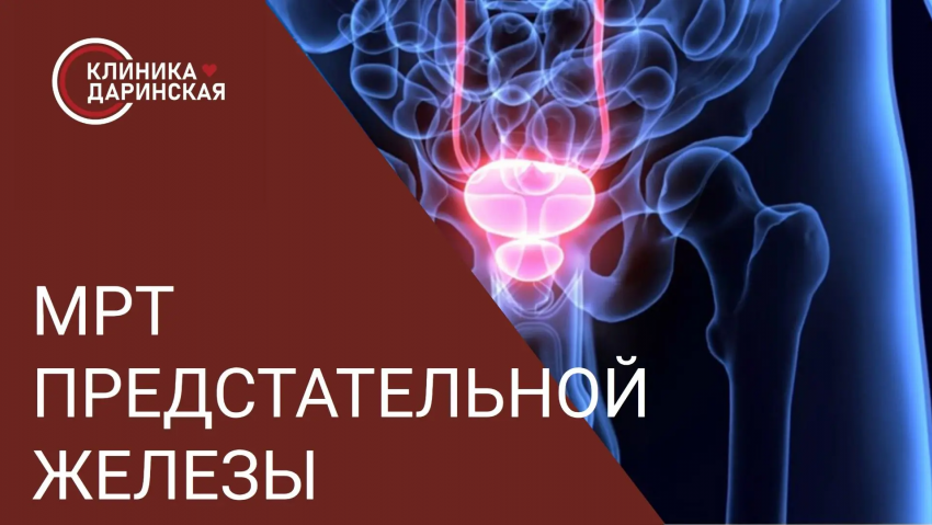 УСЛУГА ДНЯ: мпМРТ предстательной железы с контрастным усилением за 12 000 рублей в клинике «Даринская»