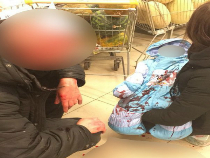 Дважды сбил машиной и отдубасил битой по голове москвича с младенцем неадекватный ростовский автомобилист