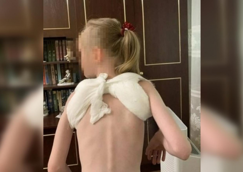 10-летний самокатчик сбил 7-летнюю девочку и сломал ей ключицу в Батайске