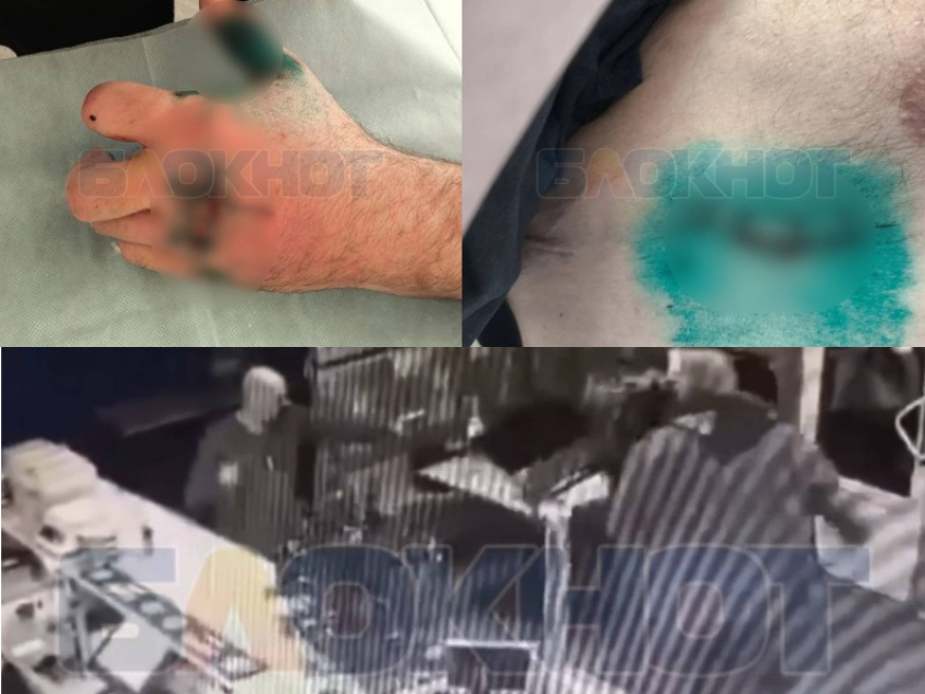 В Ростове неизвестный расстрелял и порезал охрану клуба после того, как его не пустили внутрь